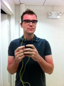 Me Sunburn