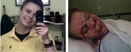 malloryowensbeforeandafter